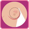 BioLogics